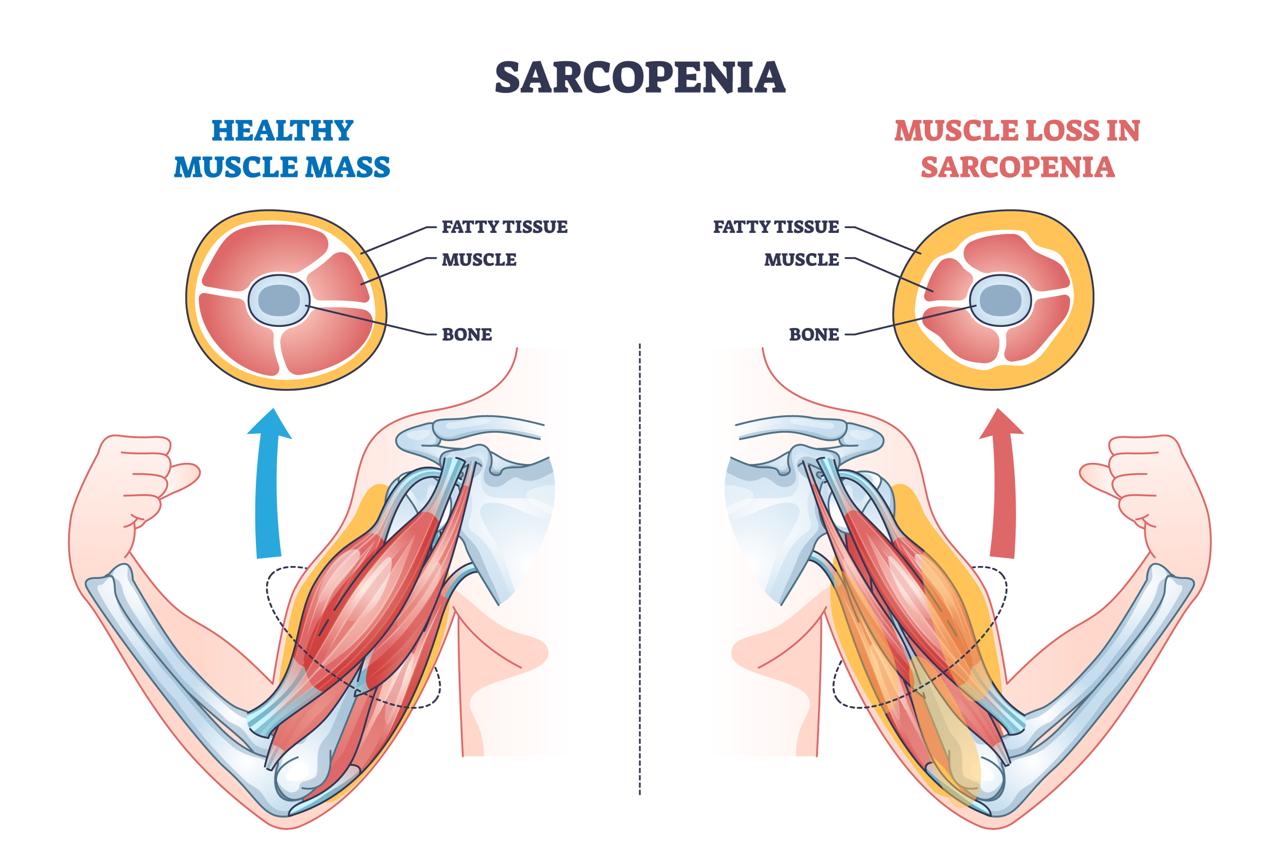 Educational graphic illustrating muscle loss and declining reserve over time